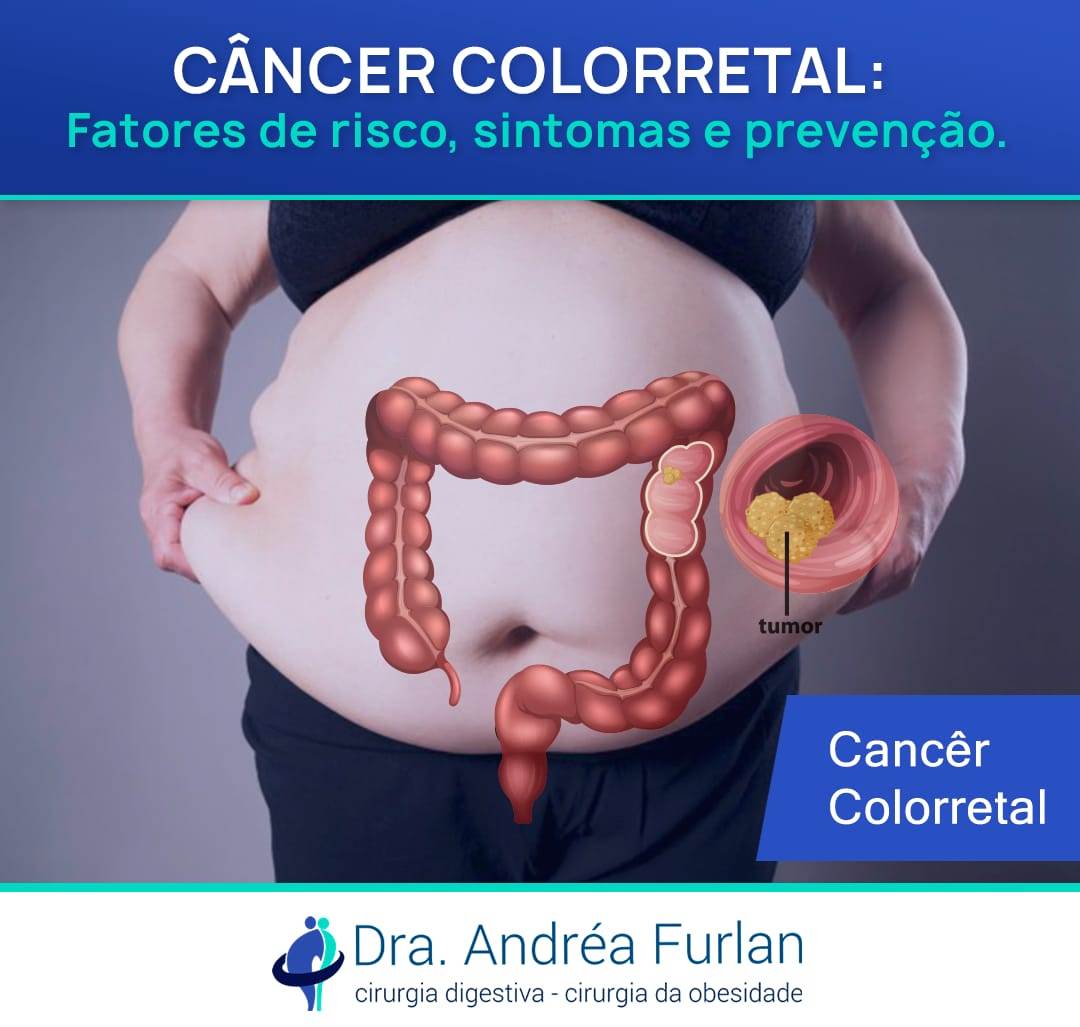 cancer colorectal en)
